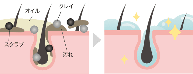 頭皮を洗浄する様子