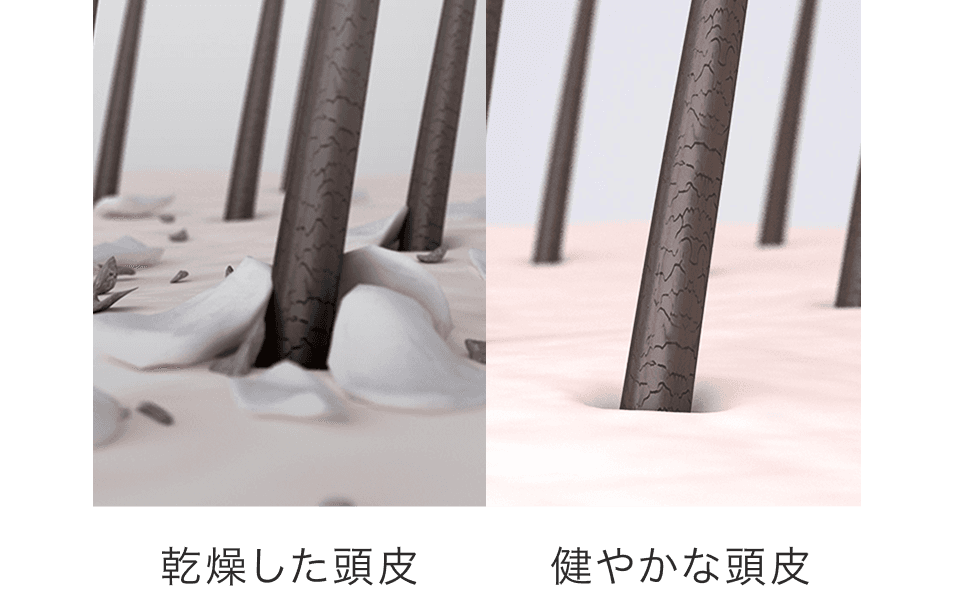 乾燥・かゆみ・エイジング悩みに健やかな頭皮環境へ整える